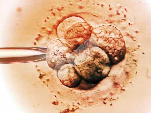 广西专业的代孕机构费用,试管婴儿促排卵期如何提升卵子质量?